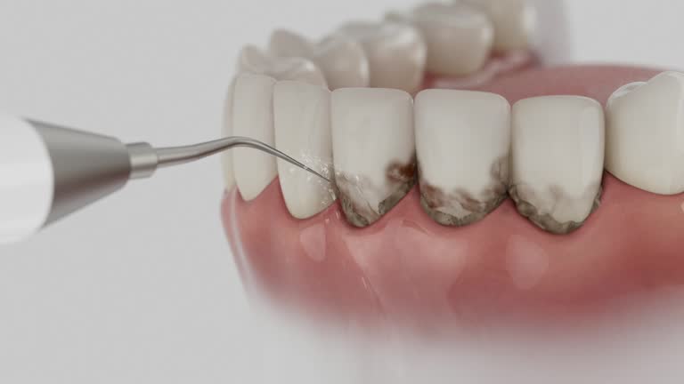 Reliable Dental contractor in Lockport, NY by Dentist Open Now